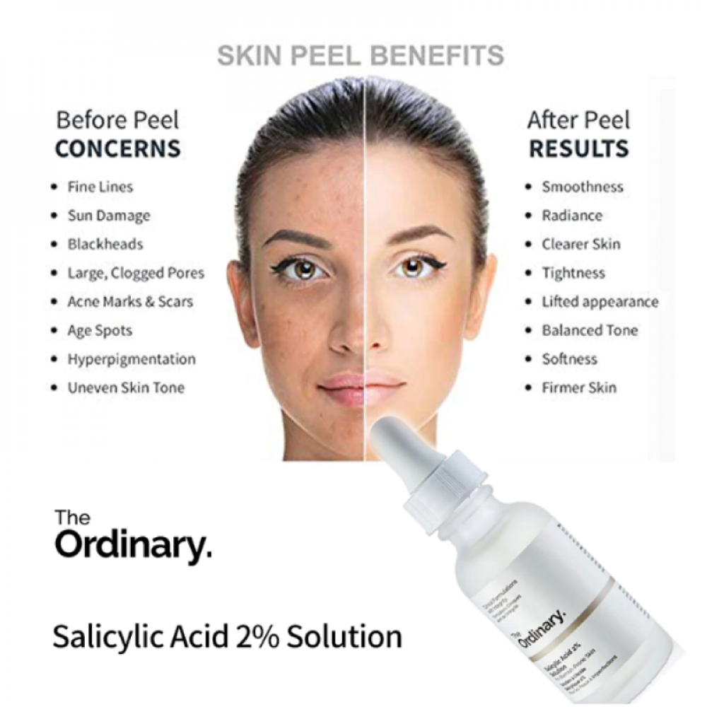 The Ordinary Salicylic Acid 2% Solution Clears Acne, Exfoliates, Reduces Blackheads, Improves Texture, Unclogs Pores, Minimizes Whiteheads, And Reduces Inflammation