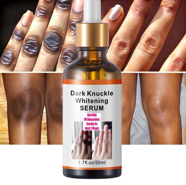 Dark Knuckles Fast Brighten Serum Women Hand Knuckle Lightening Melanin Essence Elbows Knee Fade Stains Product Brightening Care- MOOYAM-