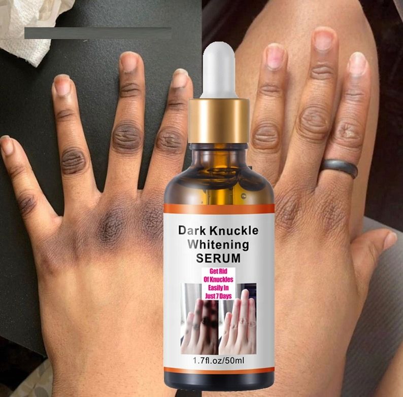 Dark Knuckles Fast Brighten Serum Women Hand Knuckle Lightening Melanin Essence Elbows Knee Fade Stains Product Brightening Care- MOOYAM-
