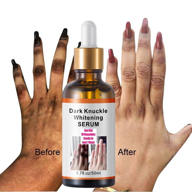 Dark Knuckles Fast Brighten Serum Women Hand Knuckle Lightening Melanin Essence Elbows Knee Fade Stains Product Brightening Care- MOOYAM-