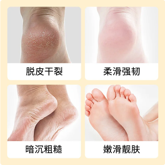 Shea Butter Foot Exfoliating Cream Moisturizing Remove Dead Skin Exfoliant Feet Pedicure Cream Foot Care Exfoliator