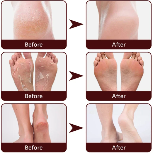 Shea Butter Foot Exfoliating Cream Moisturizing Remove Dead Skin Exfoliant Feet Pedicure Cream Foot Care Exfoliator