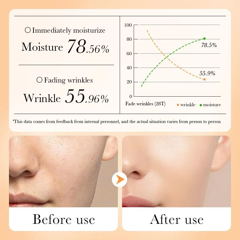 β Carrot Face Cream Anti-Aging Whitening Moisturizing Shrink Pores Repair Dry Oil Skin Facial Cream Reduce Wrinkles Fade Fine Lines Hydrating Whitening Firm Brighten Skin Care