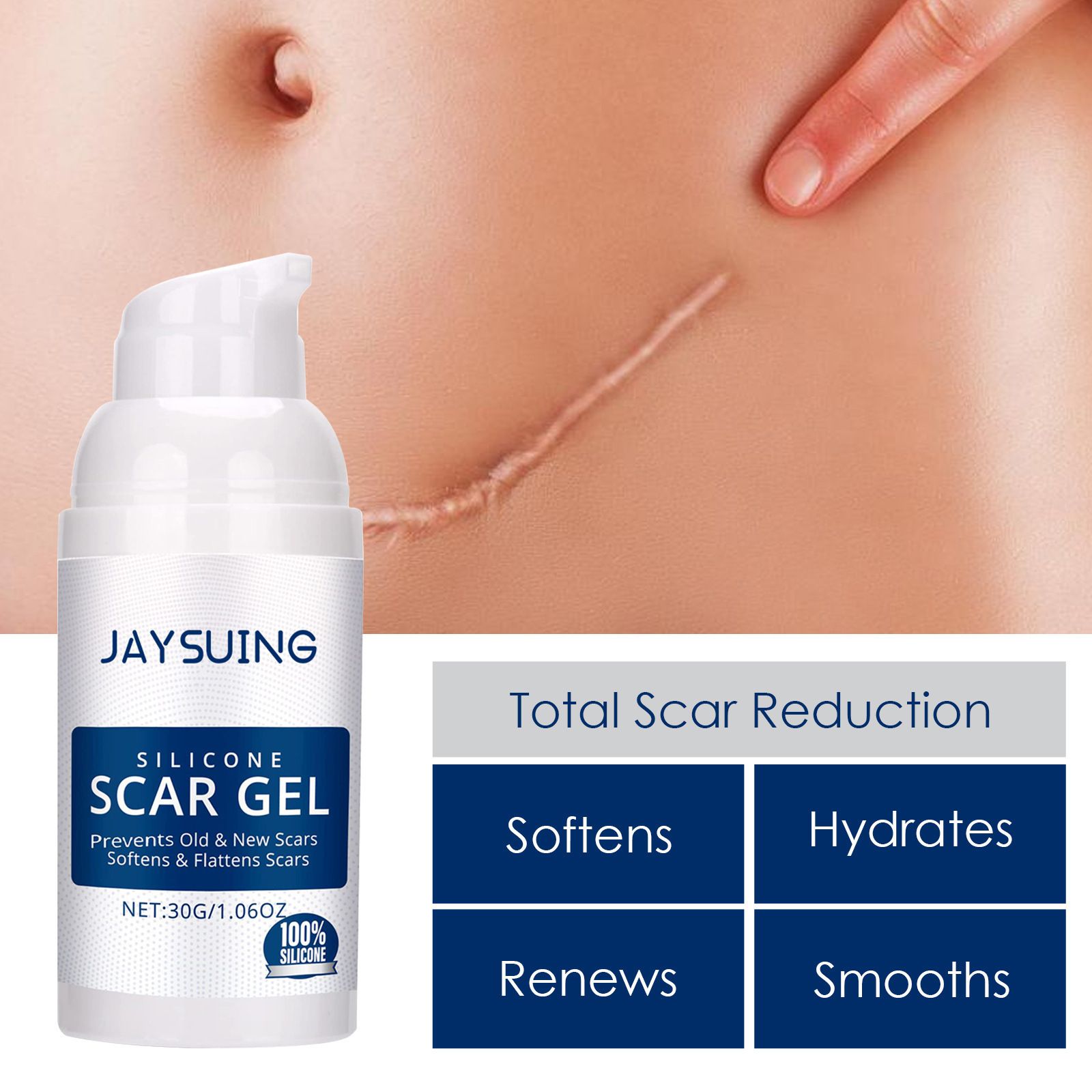 Silicone Scar Removal Gel Removal Skin Scars Cream Treat Surgery Scars Stretch Marks Acne Pox Prints Burn Repair Facial Care Gel Whitening Pigmentation Corrector