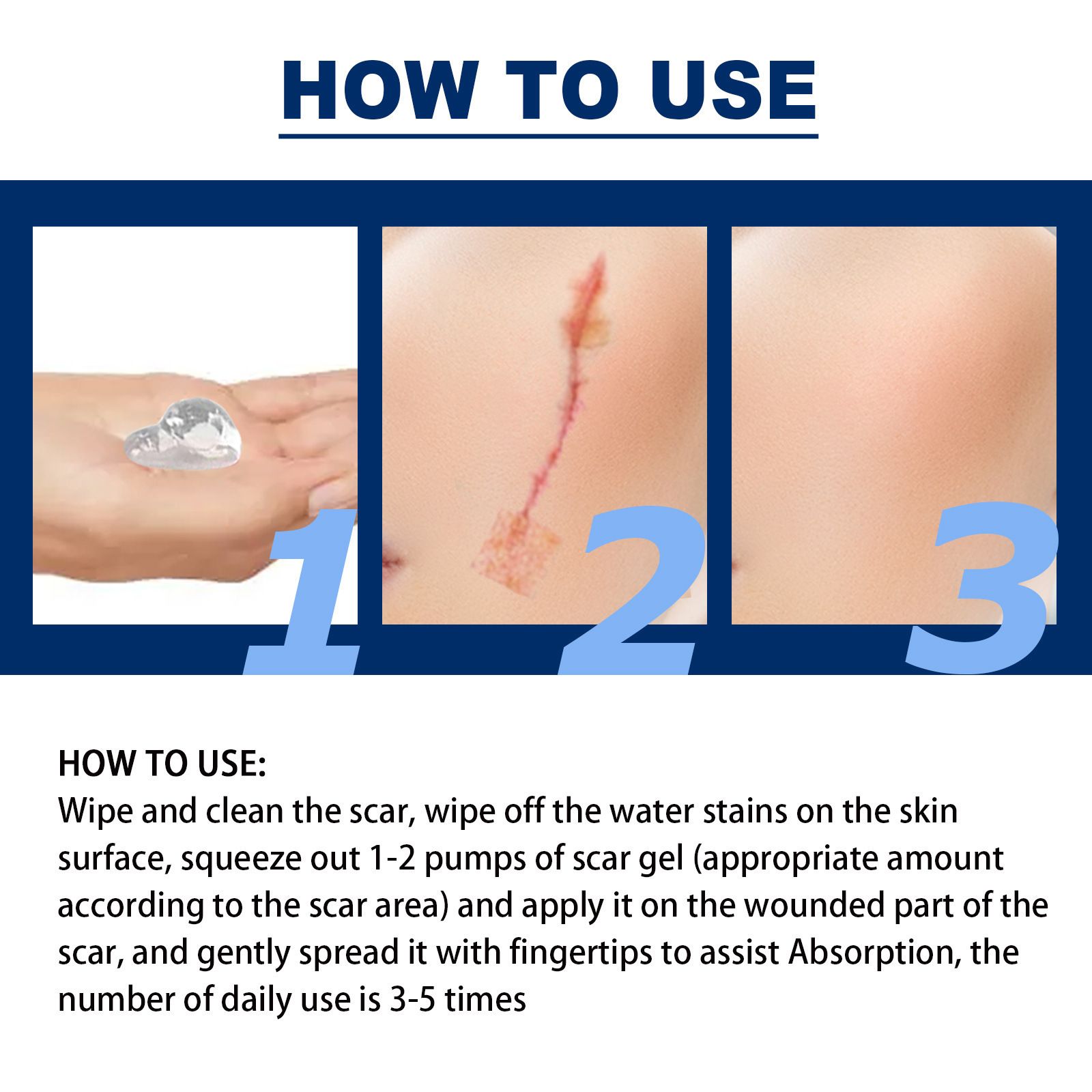 Silicone Scar Removal Gel Removal Skin Scars Cream Treat Surgery Scars Stretch Marks Acne Pox Prints Burn Repair Facial Care Gel Whitening Pigmentation Corrector