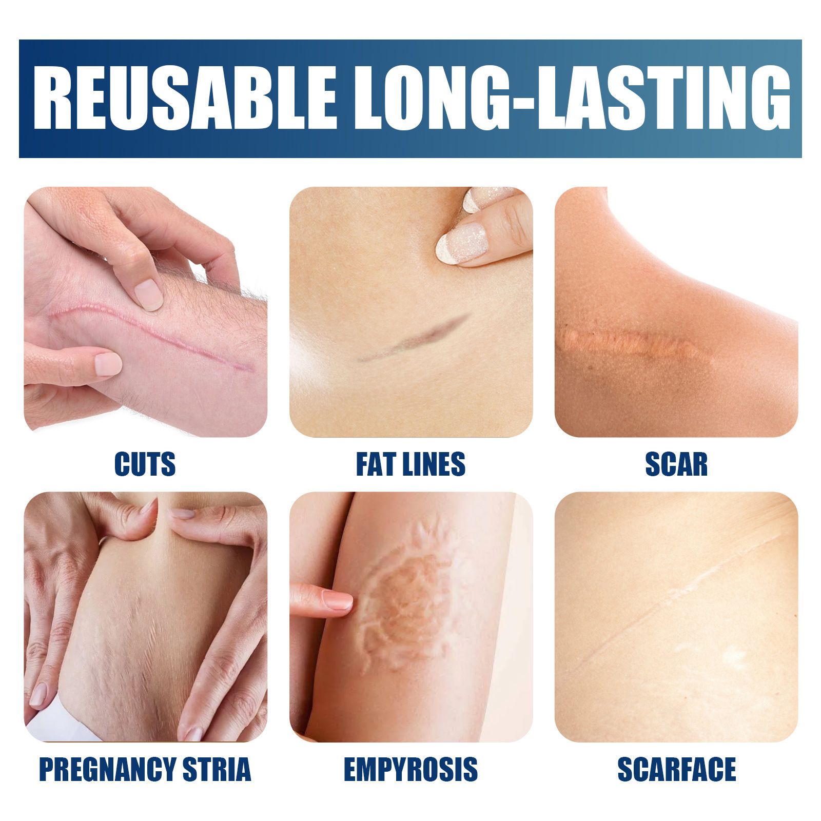 Silicone Scar Removal Gel Removal Skin Scars Cream Treat Surgery Scars Stretch Marks Acne Pox Prints Burn Repair Facial Care Gel Whitening Pigmentation Corrector