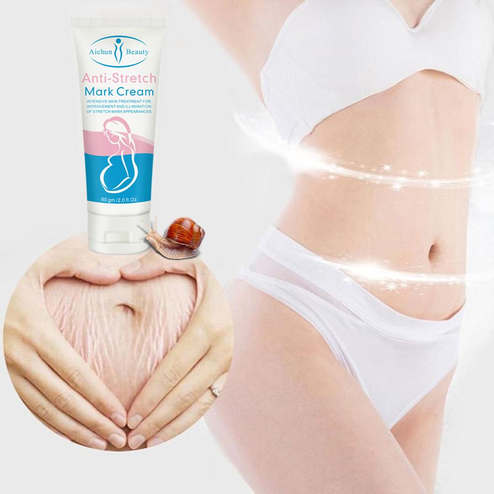 Removes Stretch Mark Cream To Remove Postpartum Obesity Pregnant Women Repair Anti-Aging Anti-Wrinkles Firming Body Cream