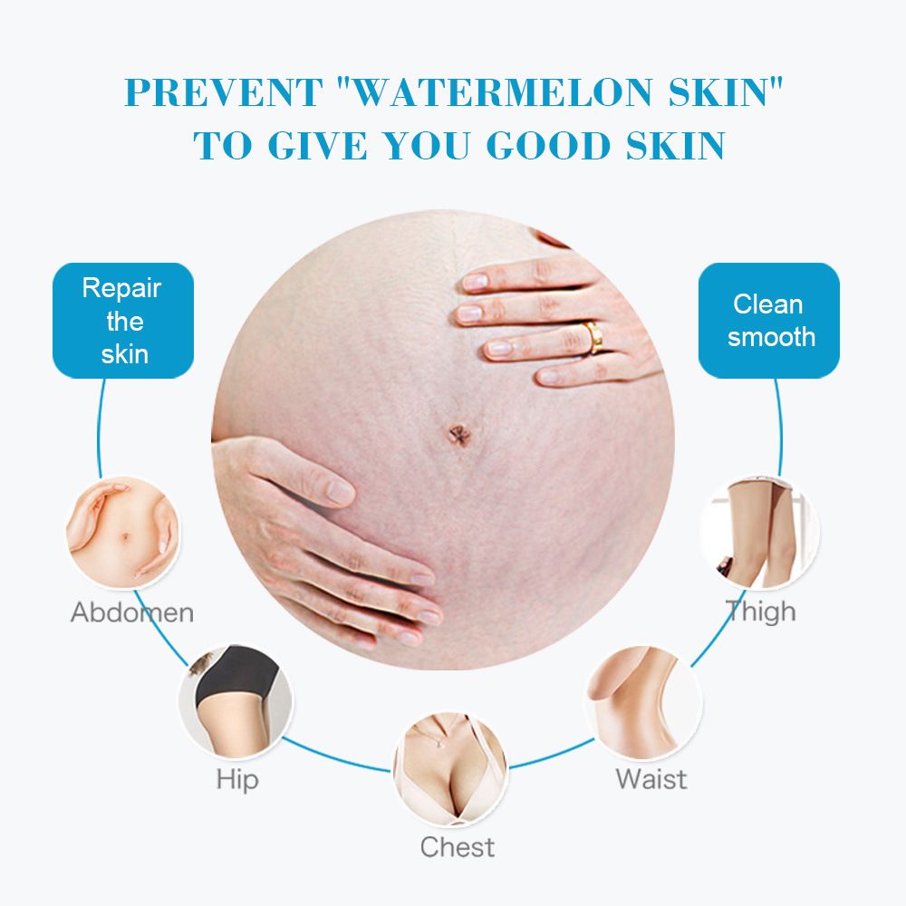 Removes Stretch Mark Cream To Remove Postpartum Obesity Pregnant Women Repair Anti-Aging Anti-Wrinkles Firming Body Cream