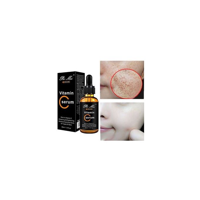 Pei Mei Vitamin C Face Serum