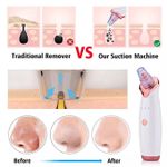 5 In 1 Blackhead Black Head Remover Vacuum Suction Cleaner