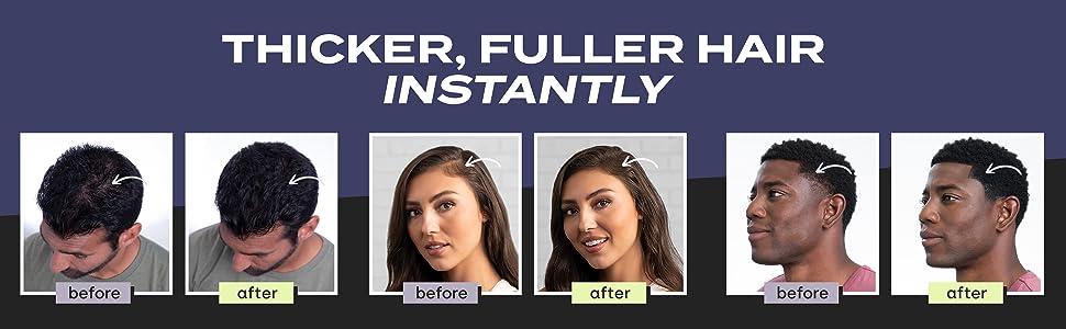 Toppik Hair Building Fibers, 27.5g Fill In Fine or Thinning Hair Instantly Thicker, Fuller Looking Hair for Men & Women