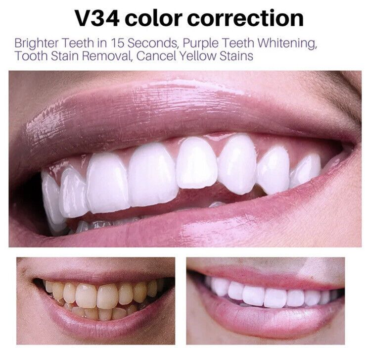 The original Lanthome V34 Purple Teeth Whitening Mousse: Advanced Teeth Whitening, Cigarette Stains Repair ,Neutralizes Yellow Tones removes Dental Plaque ,best Fresh Breath Oral Care