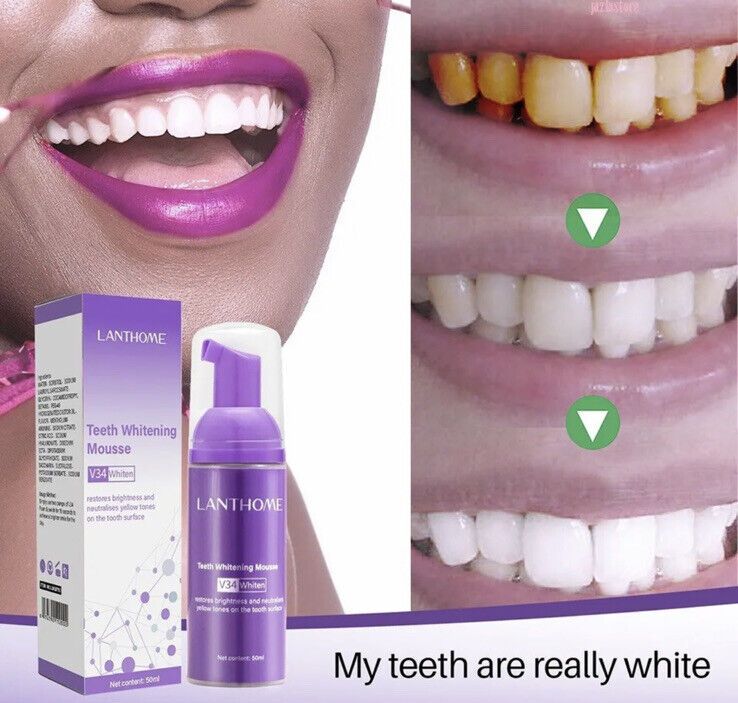 The original Lanthome V34 Purple Teeth Whitening Mousse: Advanced Teeth Whitening, Cigarette Stains Repair ,Neutralizes Yellow Tones removes Dental Plaque ,best Fresh Breath Oral Care