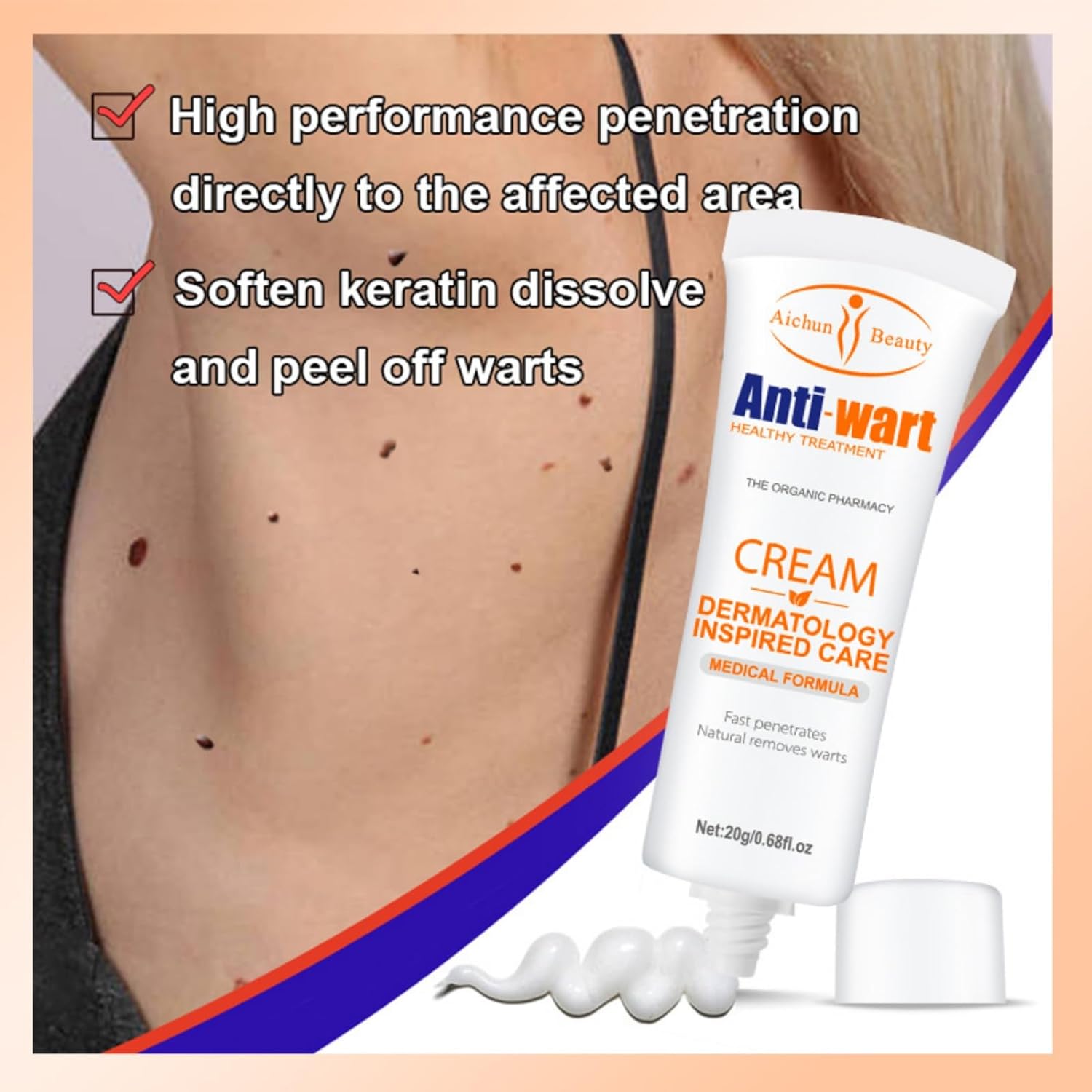 Aichun Anti-Wart Cream 20ml Effective Wart Treatment Long-Lasting Removes Warts and other Skin Imperfections, Moisturizing Non-Irritating Formula Fast-Acting, Used on the Feet, Neck, Face, and Body