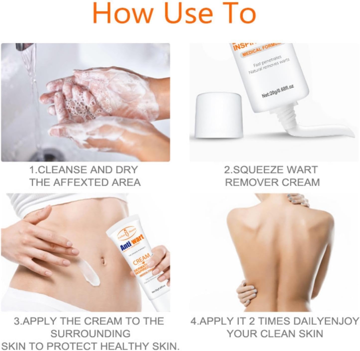 Aichun Anti-Wart Cream 20ml Effective Wart Treatment Long-Lasting Removes Warts and other Skin Imperfections, Moisturizing Non-Irritating Formula Fast-Acting, Used on the Feet, Neck, Face, and Body