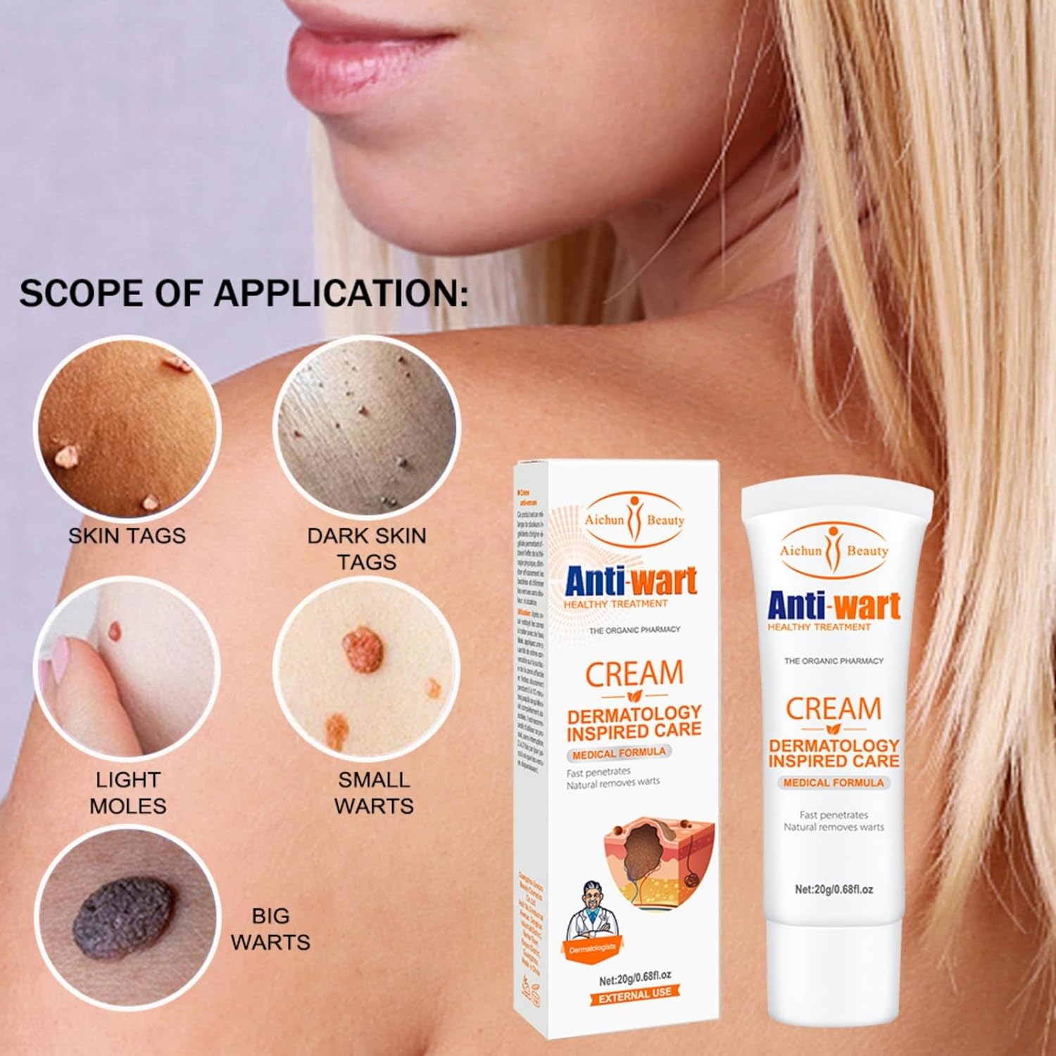 Aichun Anti-Wart Cream 20ml Effective Wart Treatment Long-Lasting Removes Warts and other Skin Imperfections, Moisturizing Non-Irritating Formula Fast-Acting, Used on the Feet, Neck, Face, and Body
