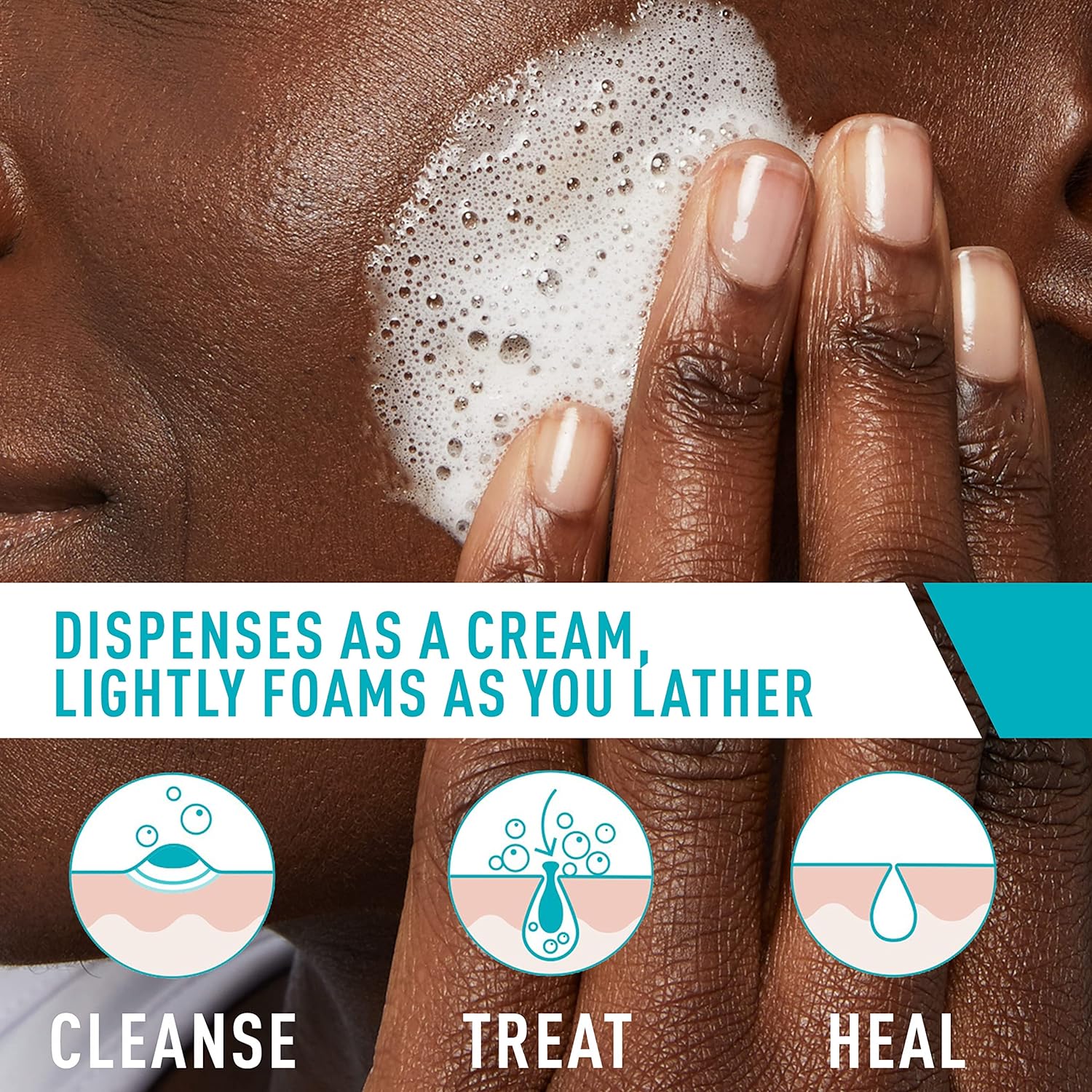 Foaming Cream Cleanser | Acne Treatment Face Wash with 4% Benzoyl Peroxide, Hyaluronic Acid, and, Niacinamide | Cream to Foam Formula | Fragrance Free