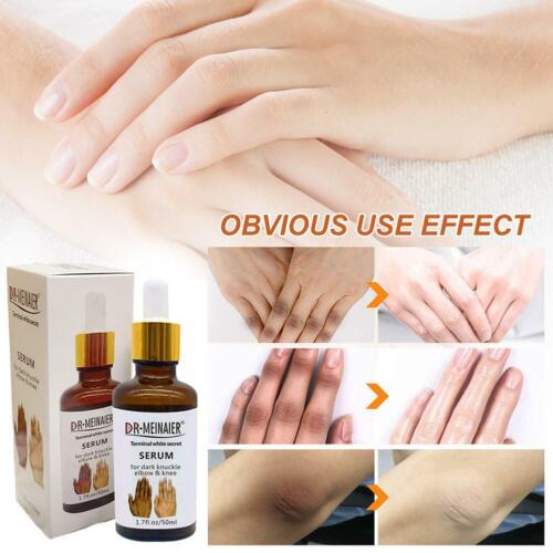 DR MEINAIER Terminal White Secret Serum For Dark Knuckle Elbow & Knee, 50ml Whitening Skin Revitalizer Nourishing Moisturizer Lightening Firming Anti-Wrinkle Creams & Moisturizers 50ml
