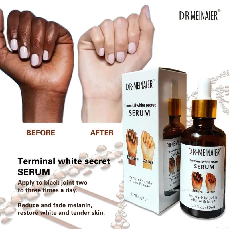 DR MEINAIER Terminal White Secret Serum For Dark Knuckle Elbow & Knee, 50ml Whitening Skin Revitalizer Nourishing Moisturizer Lightening Firming Anti-Wrinkle Creams & Moisturizers 50ml