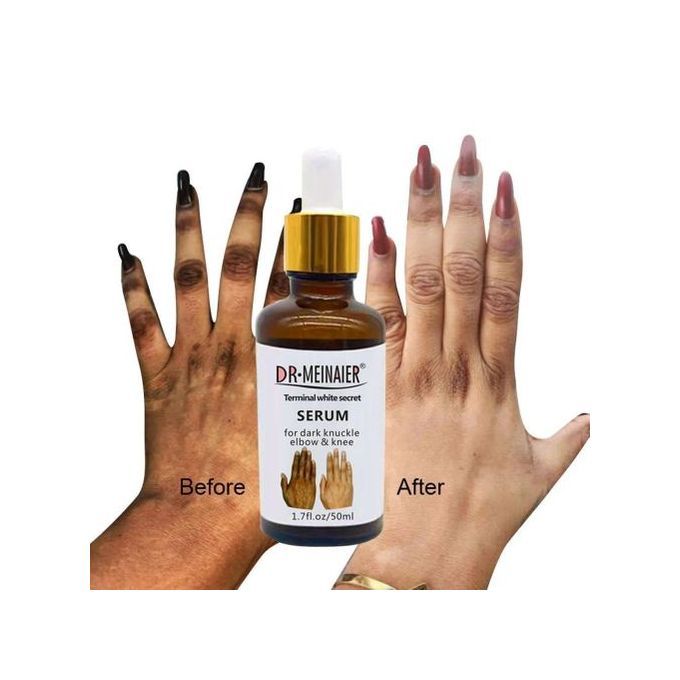 DR MEINAIER Terminal White Secret Serum For Dark Knuckle Elbow & Knee, 50ml Whitening Skin Revitalizer Nourishing Moisturizer Lightening Firming Anti-Wrinkle Creams & Moisturizers 50ml