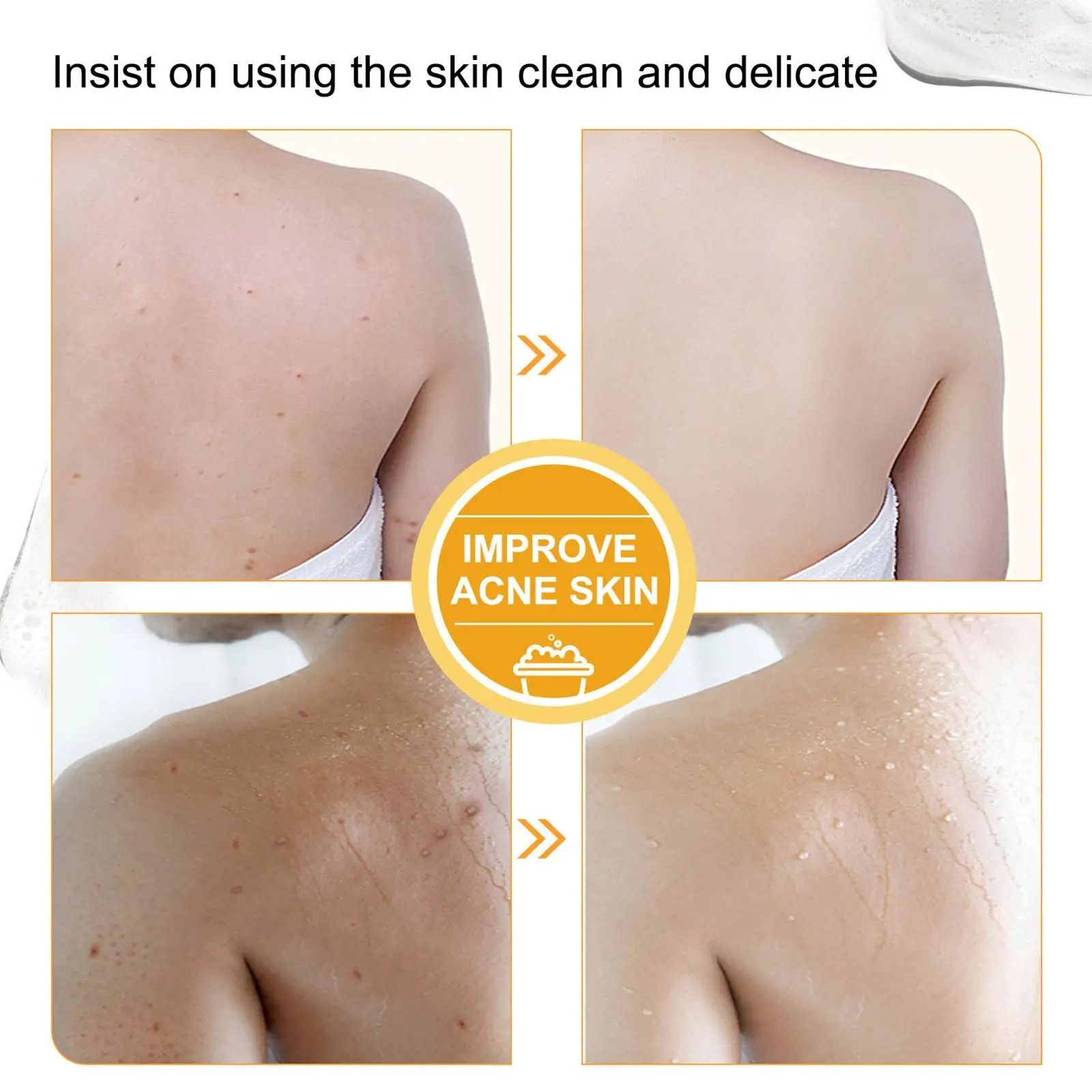 Lee Kojic Papaya Soap for Skin Shine 100g Whitening Handmade Papaya Dehumidifier for Whitening Soap with Dark Soap Extract Sp A7A9  Heals Acne or Pimples Sun spots & Freckles