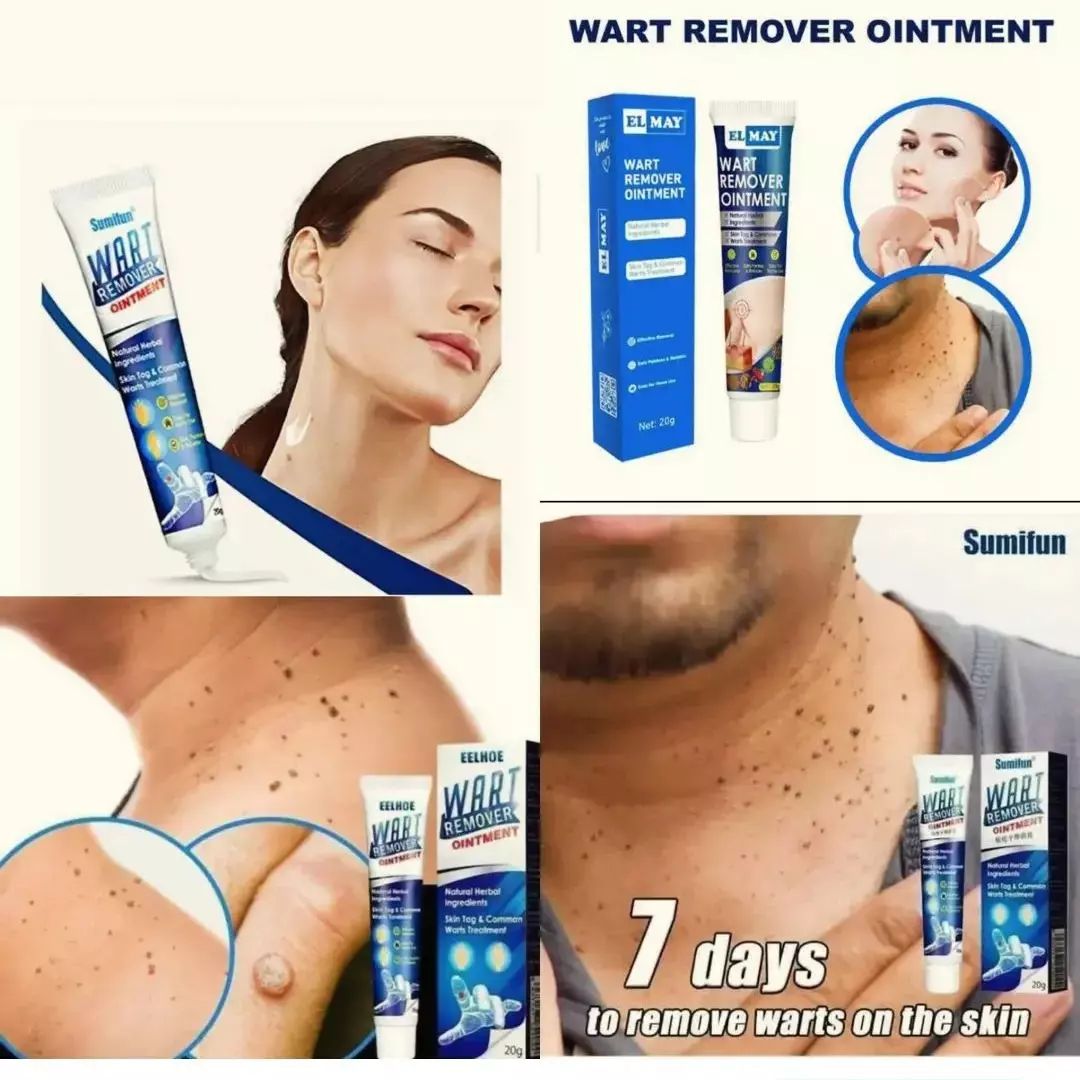 Sumifun Wart Remover Cream, Skin Tag Remover for Common Warts, Corn, Callus Warts &amp; Skin Tag Removal Natural Ingredients Portable Sumifun Wart Remover Cream