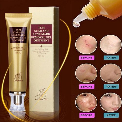 TCM Scar And Acne Mark Removal Gel Ointment -30G