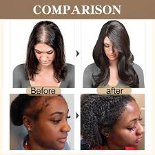 【Clearance Sale】Raw Batana Oil For Hair Growth 100% Pure And Natural Batana Oil For Treating Hair Loss Anti-Breakage Hair Loss Treatment