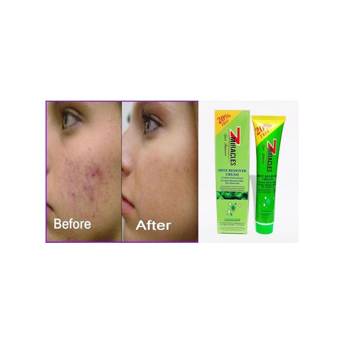 7 Miracles Spot Remover Cream
