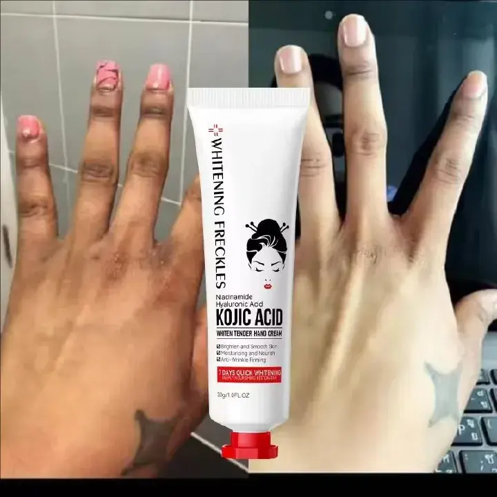Intensive Moisturizing Hand Cream Skincare Set for Dry, Cracked Hands with Kojic Acid, Glycerin, Hyaluronic Acid, and Nicotinamide - Soft, Smooth, and Nourished Hands for All Skin Types, Alcohol-Free