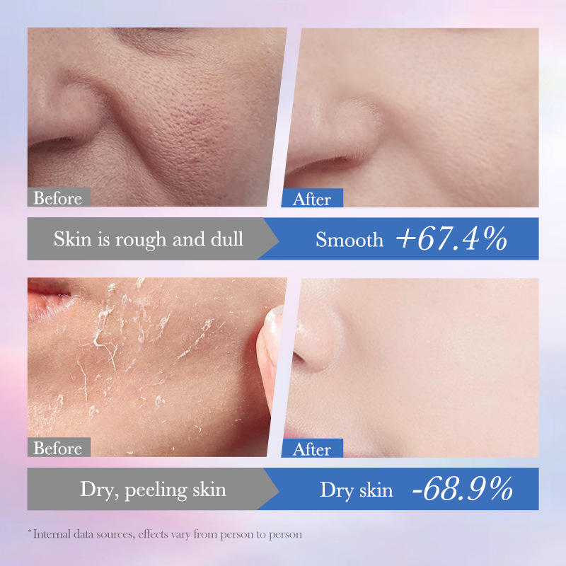 [Promotion] SADOER Niacinamide Spot Removal All Skin Types Repair Toner 100ml Deep Hydrating Brightening Face Smooth Water