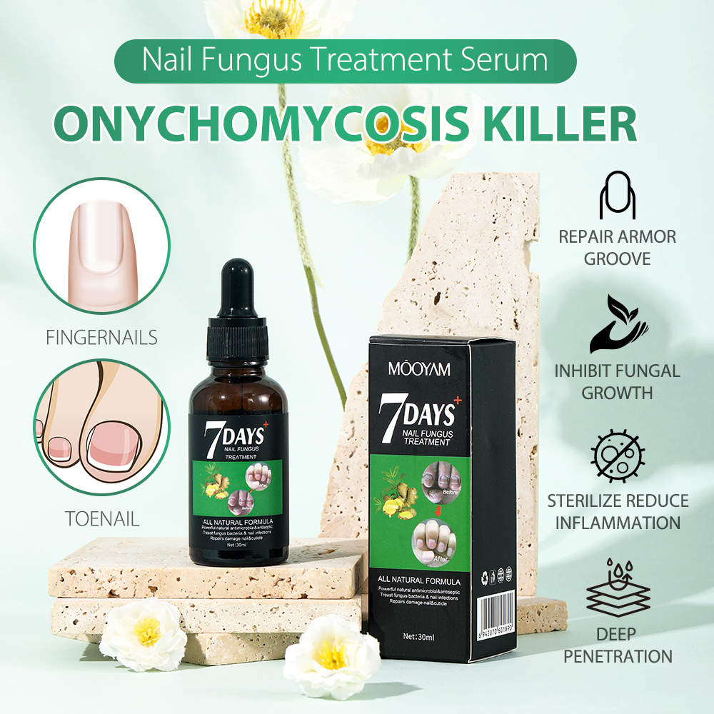 Fungal Nail Treatment Oil Foot Repair Essence Toe Nail Fungus Repair fungus bacteria repair Foot Hands Gel Anti Infection Cream Fungal Nail Removal 30ml- MOOYAM