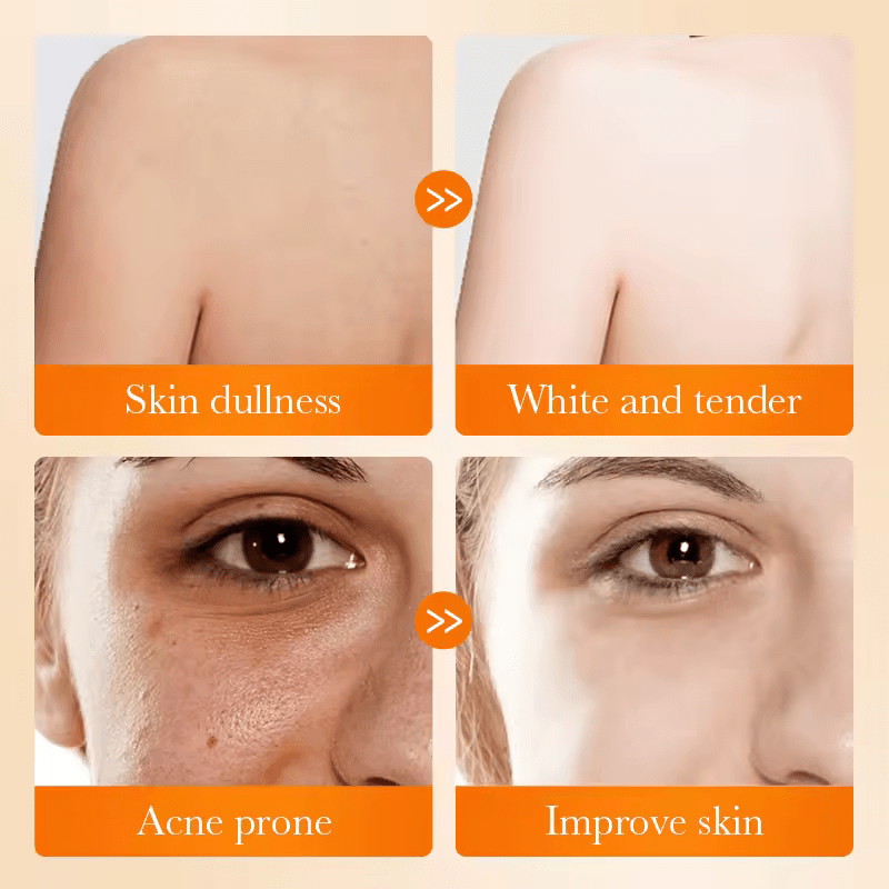 Kojic Soap 3 Pieces SADOER Kojic Acid Whitening Soap, Deep Cleansing, Skin Brightening Like Vitamin C, Improve Acne Prone Skin, For Face and Body Skin Care