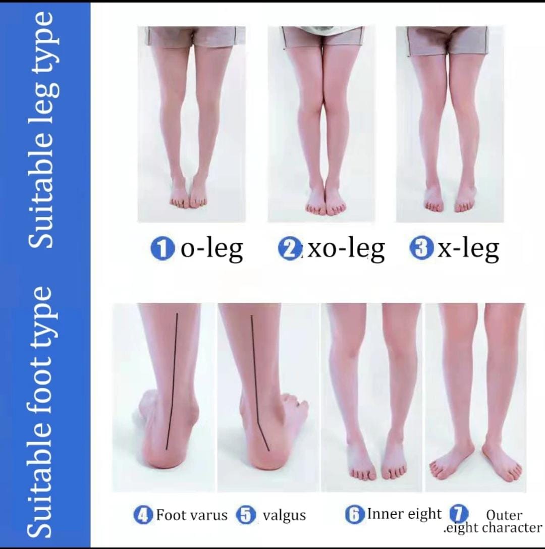 1 Pair Silicone orthopedic insoles for feet - valgus varus correction plantar fasciitis gel insole massager foot care, Made from 100% pure medical-grade silicone gel, ensuring durability and safety