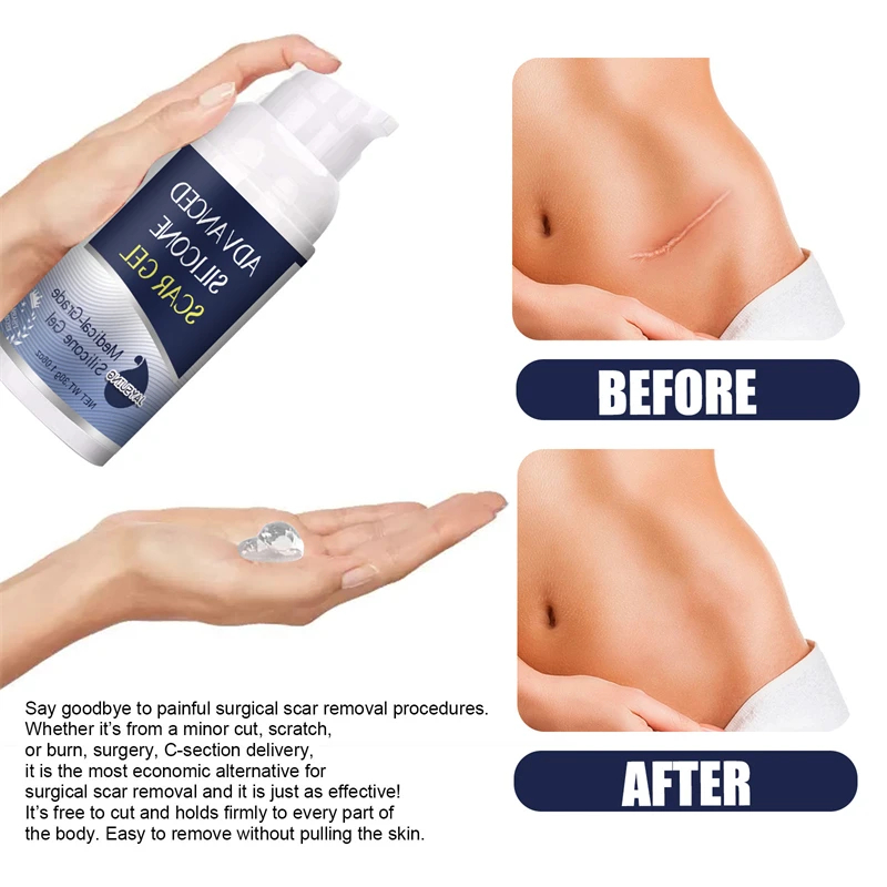 Advanced silicone scar gel, medical grade scar removal gel