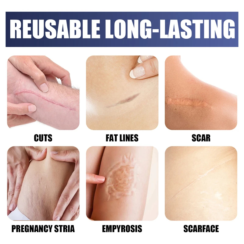 Advanced silicone scar gel, medical grade scar removal gel