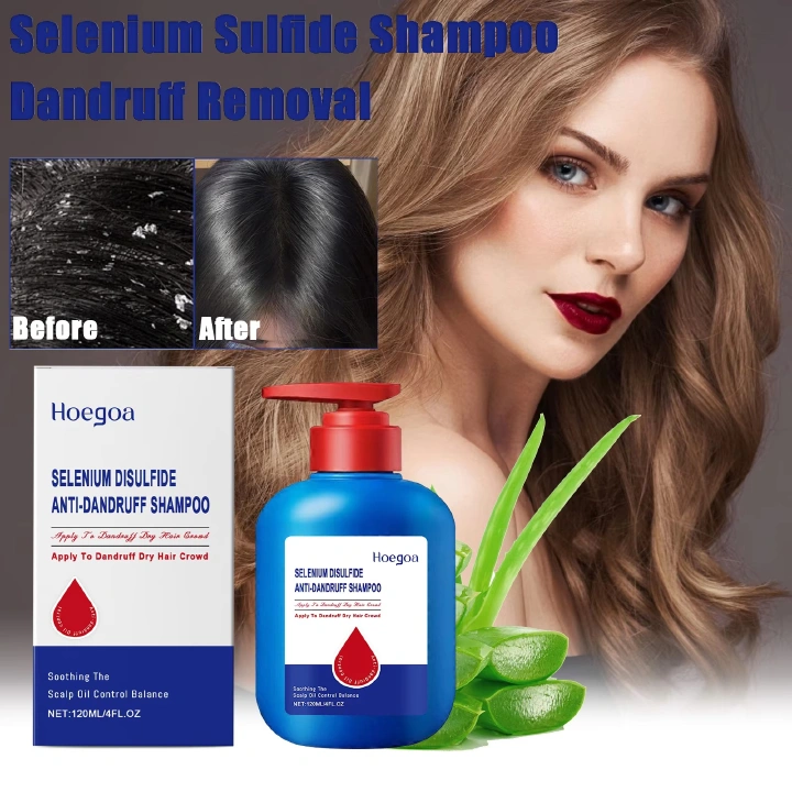Selenium Sulfide Hair Shampoo Deep Cleansing Scalp Remove Dandruff Refreshing Strengthen Hair Roots Smoothing Soften Shiny Hair