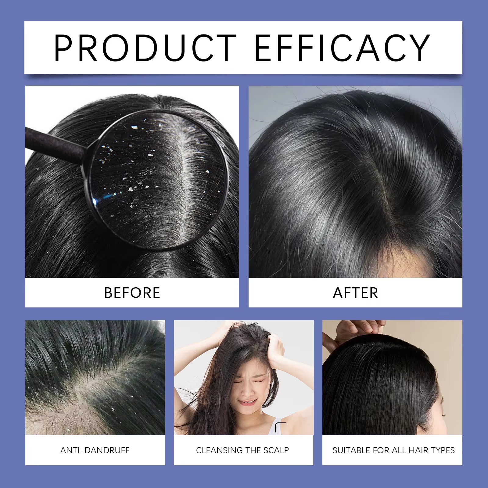 Selenium Sulfide Hair Shampoo Deep Cleansing Scalp Remove Dandruff Refreshing Strengthen Hair Roots Smoothing Soften Shiny Hair
