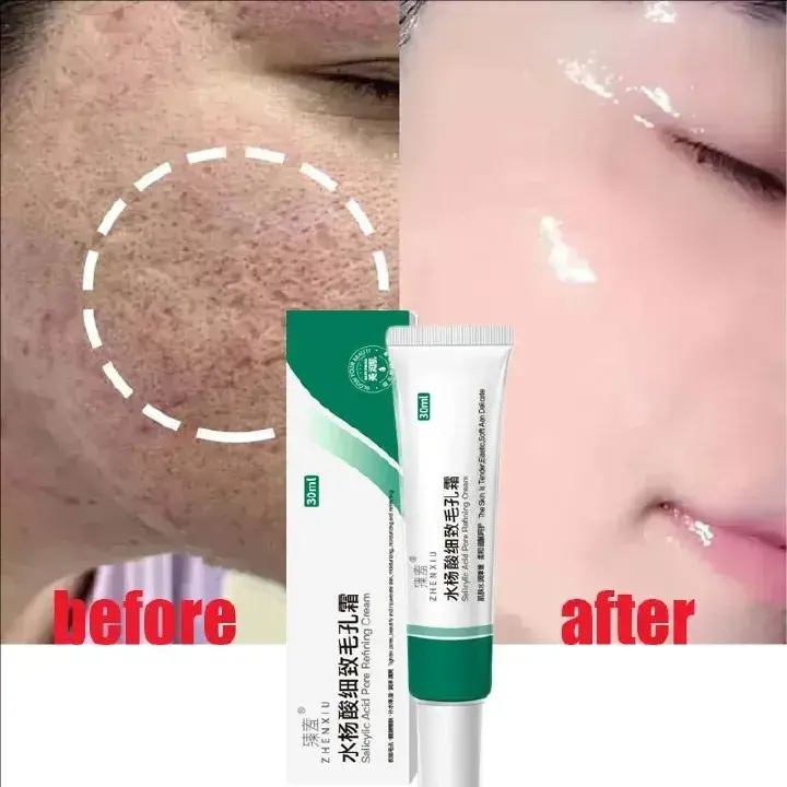 Moisturizing Face Cream, Containing Glycerin, Salicylic Acid and Hydrolyzed Collagen - Moisturizing and Smooth, Used Day and Night, Suitable for Skin Types, Care for Facial Skin
