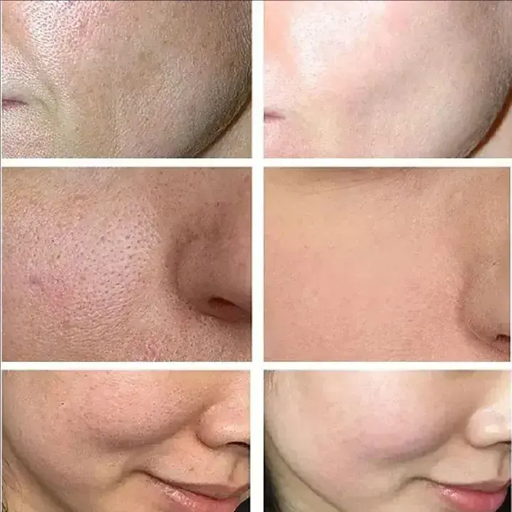 Moisturizing Face Cream, Containing Glycerin, Salicylic Acid and Hydrolyzed Collagen - Moisturizing and Smooth, Used Day and Night, Suitable for Skin Types, Care for Facial Skin