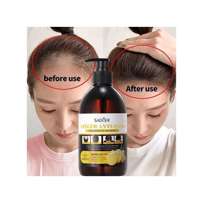 SADOER Anti Hair Loss Treatment Shampoo