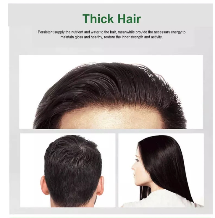 Dexe Anti Hair Loss Lotion Natural Organic Hair Root Nutrient Solution Promotes Hair Growth - LIKE NEO HAIR GROWTH 120ml