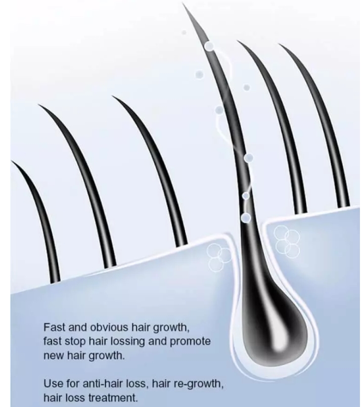 Dexe Anti Hair Loss Lotion Natural Organic Hair Root Nutrient Solution Promotes Hair Growth - LIKE NEO HAIR GROWTH 120ml