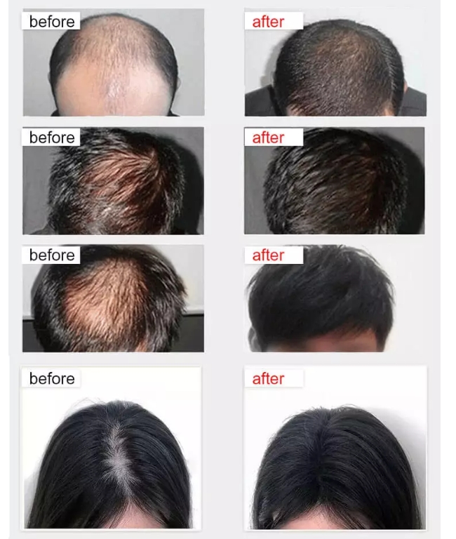 Dexe Anti Hair Loss Lotion Natural Organic Hair Root Nutrient Solution Promotes Hair Growth - LIKE NEO HAIR GROWTH 120ml