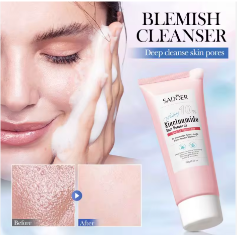 SADOER 10% Niacinamide Spot Removal Gentle Cleanser  SADOER 3% Salicylic Acid  Dispel Acne Amino Acid Gentle Cleanser For Deep Gentle Cleansing Brightening Skin & Moisturize, Refresh and Control Oil