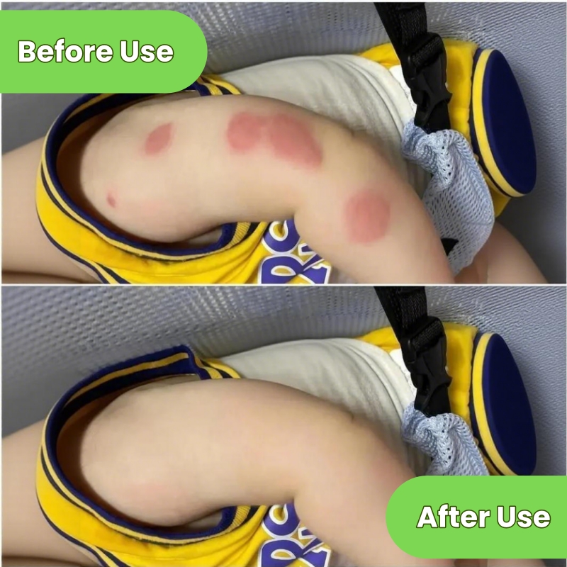 KORMESIC Mosquito Repellent Spray - Long-Lasting Protection Stops Itching & Skin Cooling - Gentle Formula Non-Greasy Pleasant Fragrance - Family Friendly for All Ages - Effective Mosquito Protection
