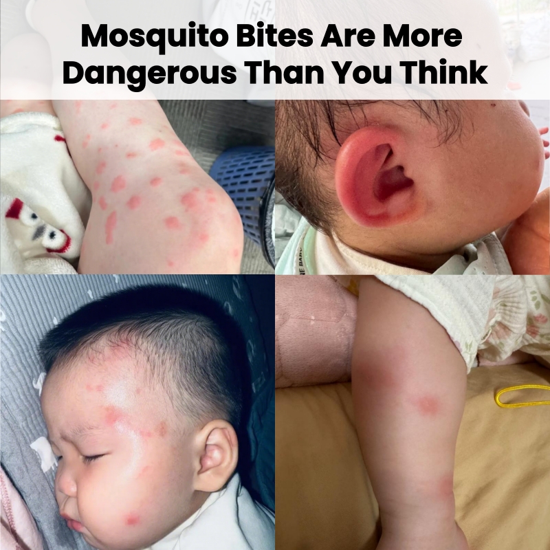 KORMESIC Mosquito Repellent Spray - Long-Lasting Protection Stops Itching & Skin Cooling - Gentle Formula Non-Greasy Pleasant Fragrance - Family Friendly for All Ages - Effective Mosquito Protection