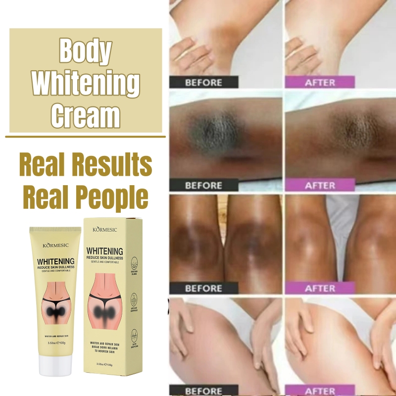 KORMESIC Darkening Bleach Cream Niacinamide Body Whitening Cream Darkening Bleach Private Parts Underarm Inner Thigh Intimate Bleaching Serum Whiten Knee Butt Knuckles Brighten Cream Armpits