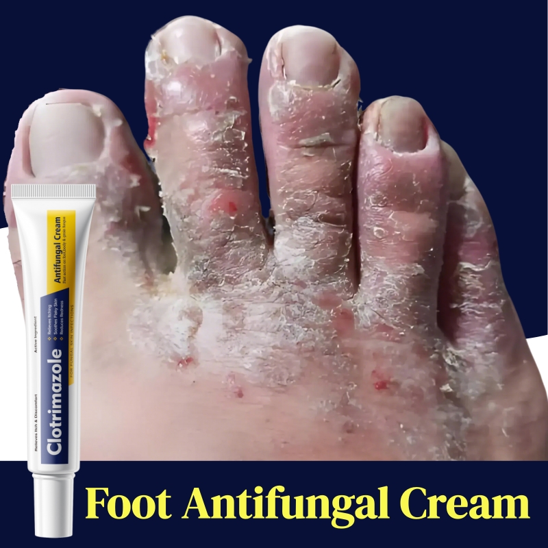 KORMESIC Foot Antifungal Cream – Fast Relief Foot Fungal Infections | Relieves Itching Soothes Peeling Skin & Reduces Redness | OTC Topical Treatment for Toe & Foot Fungus | Effective Daily Foot Care