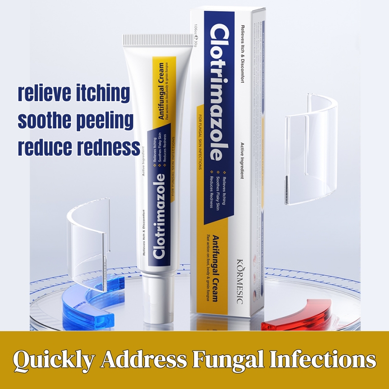 KORMESIC Foot Antifungal Cream – Fast Relief Foot Fungal Infections | Relieves Itching Soothes Peeling Skin & Reduces Redness | OTC Topical Treatment for Toe & Foot Fungus | Effective Daily Foot Care